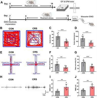 Regulation of CeA-Vme projection in masseter hyperactivity caused by restraint stress